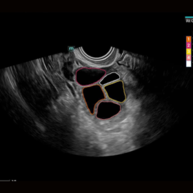 Dormed Hellas Mindray Consona N7 Smart FLC