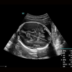 Dormed Hellas Mindray Consona N7 Smart OB