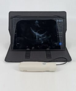 Dormed Hellas WIFI_1 Phased Array Cardiology