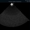 Dormed Hellas S4-2_4 Phased Array Cardiology