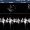 Dormed Hellas S5-1_7 Phased Array Cardiology