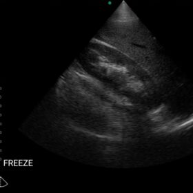 Dormed Hellas Wifi abdominal_1