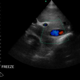 Dormed Hellas Wifi abdominal_2
