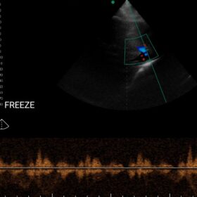 Dormed Hellas Wifi abdominal_3