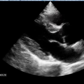 Dormed Hellas Wifi cardio_1