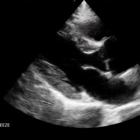 Dormed Hellas Wifi cardio_1