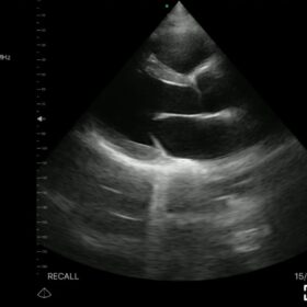 Dormed Hellas Wifi cardio_2