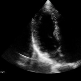 Dormed Hellas Wifi cardio_3