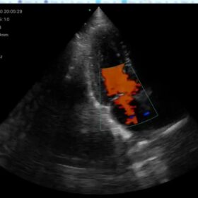 Dormed Hellas Wifi cardio_5