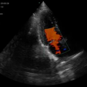 Dormed Hellas Wifi cardio_5