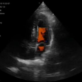 Dormed Hellas Wifi cardio_6