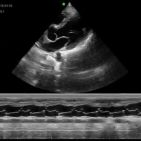 Dormed Hellas Wifi cardio_7