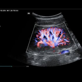 Dormed Hellas MX7 - Renal Perfusion