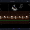 Dormed Hellas S11_9 Phased Array Cardiology