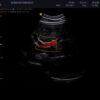 Dormed Hellas 3D4-8ET_6 Obstetrics Convex