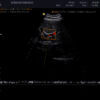 Dormed Hellas 3D4-8ET_7 Obstetrics Convex