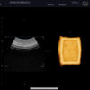 Dormed Hellas 3D4-8ET_8 Obstetrics Convex