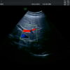 Dormed Hellas eM6C_7 Obstetrics Convex