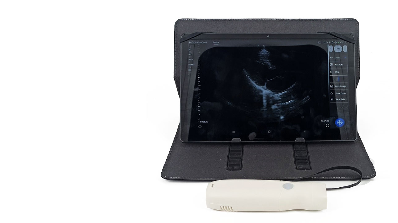 Dormed Hellas WIFI_1 Phased Array Cardiology