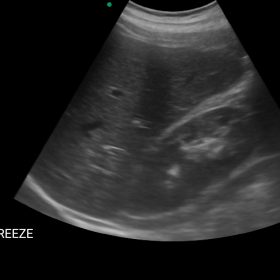 Dormed Hellas Wifi Abdominal 2