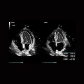 Dormed Hellas Mindray Consona N6 Auto EF