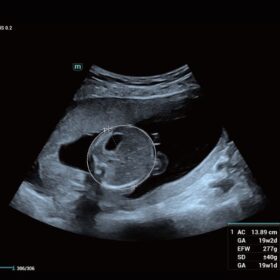 Dormed Hellas Mindray Consona N6 Smart OB