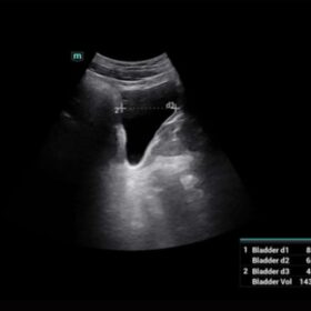 Dormed Hellas Mindray Consona N6 Smart Bladder