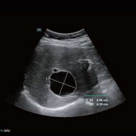 Dormed Hellas Mindray Consona N6 Smart Calc