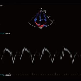 Dormed Hellas Mindray Consona N6 TDI