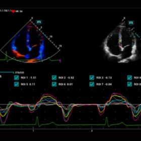 Dormed Hellas Mindray Consona N6 TDI QA