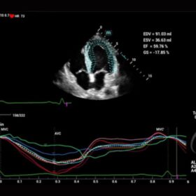 Dormed Hellas Mindray Consona N6 TTQA