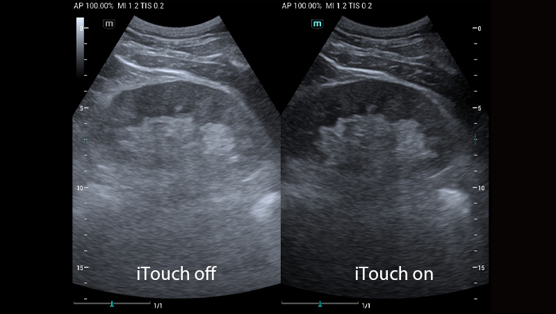 Mindray MU9 – Diagnostic Ultrasound System - Image 3