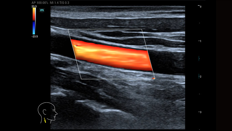 Mindray MU9 – Diagnostic Ultrasound System - Image 4
