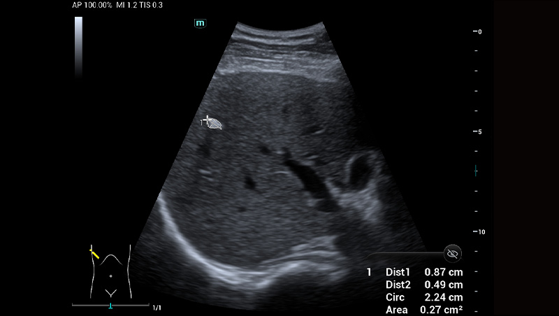 Mindray MU9 – Diagnostic Ultrasound System - Image 5