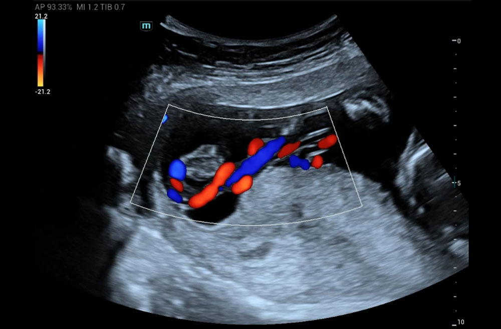 Mindray MU9 – Diagnostic Ultrasound System - Image 17