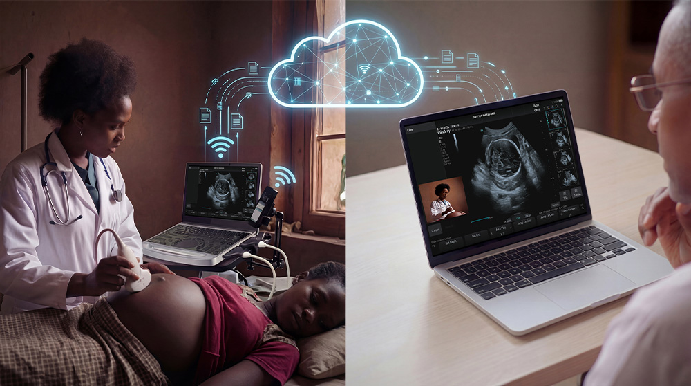Mindray MU7 – Diagnostic Ultrasound System - Image 3