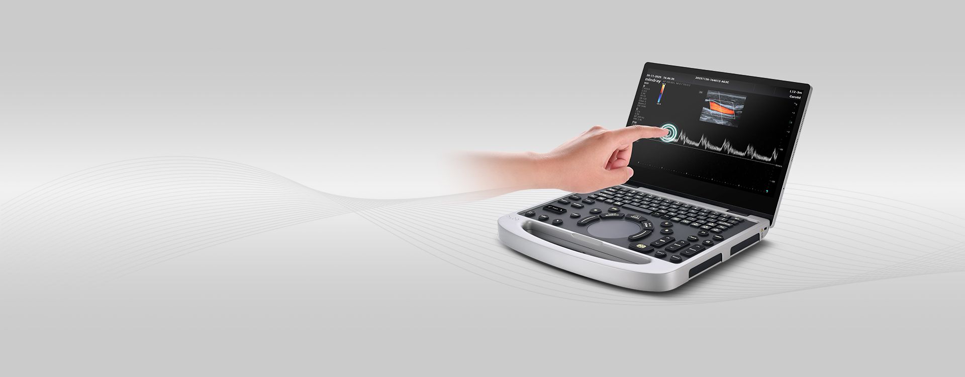 Mindray MU9 Diagnostic Ultrasound System