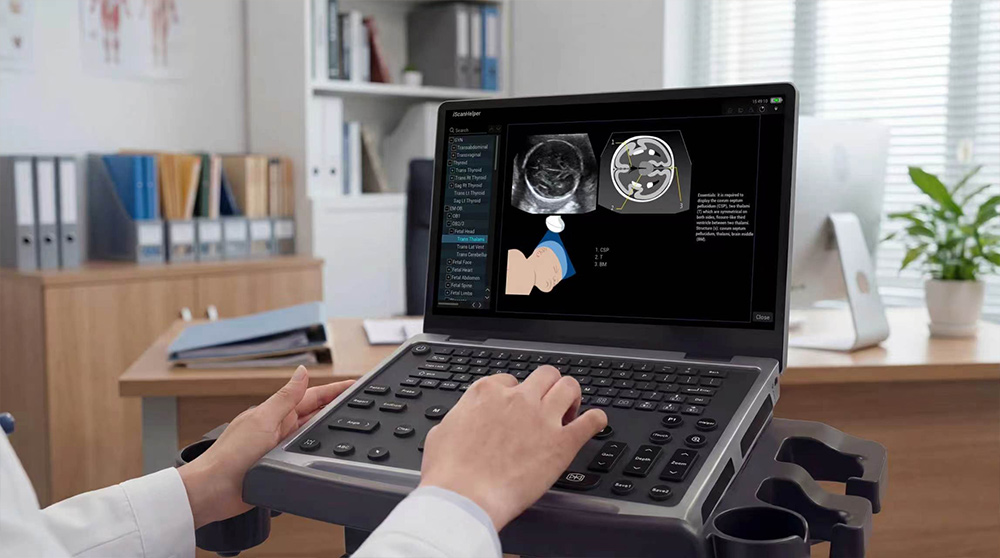 Mindray MU7 – Diagnostic Ultrasound System - Image 4
