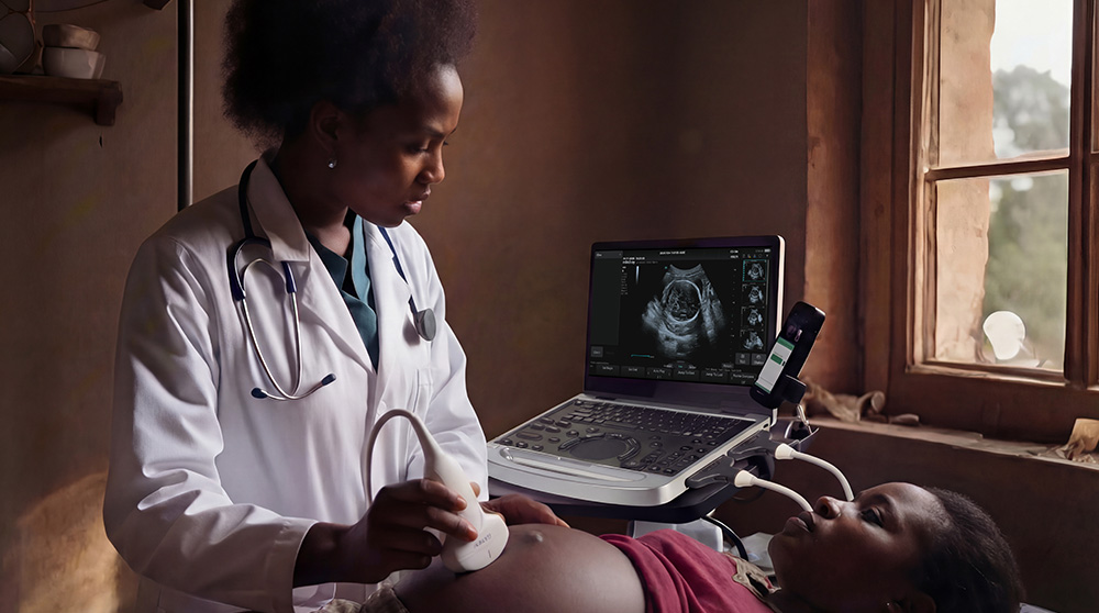 Mindray MU7 – Diagnostic Ultrasound System - Image 5