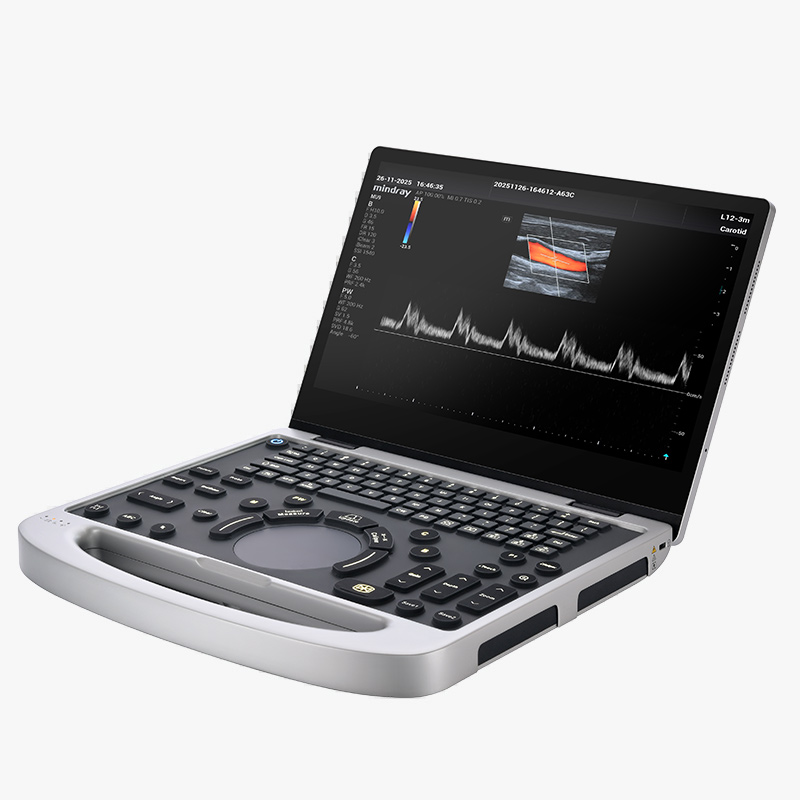 Mindray MU9 – Diagnostic Ultrasound System - Image 14