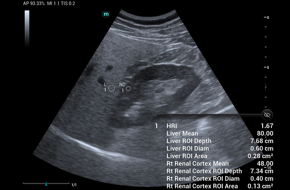 Mindray MU9 – Diagnostic Ultrasound System - Image 8