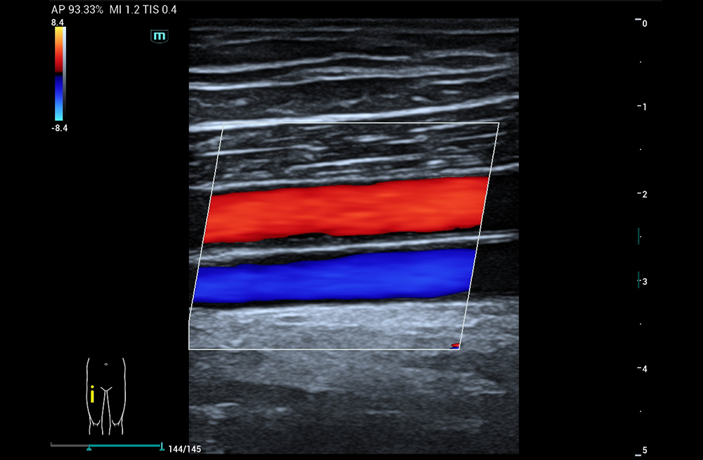 Mindray MU7 – Diagnostic Ultrasound System - Image 9