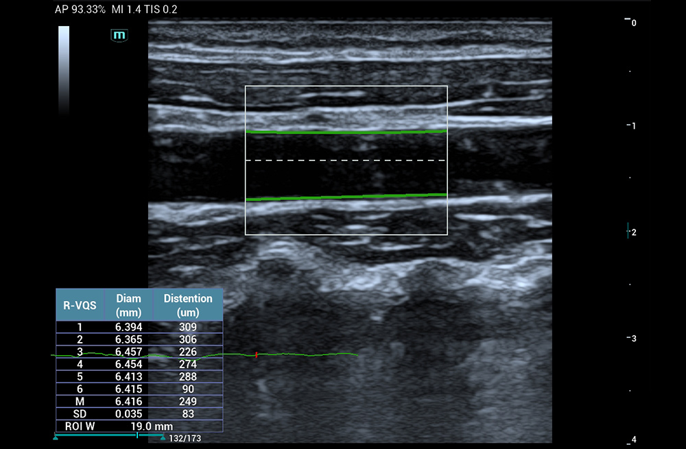 Mindray MU9 – Diagnostic Ultrasound System - Image 7