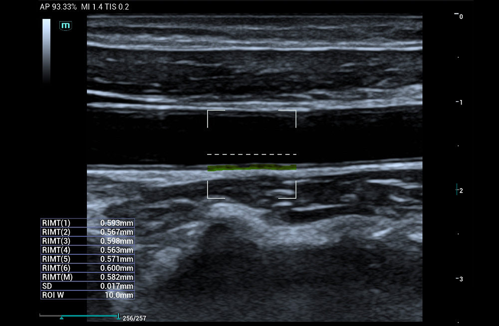 Mindray MU9 – Diagnostic Ultrasound System - Image 6