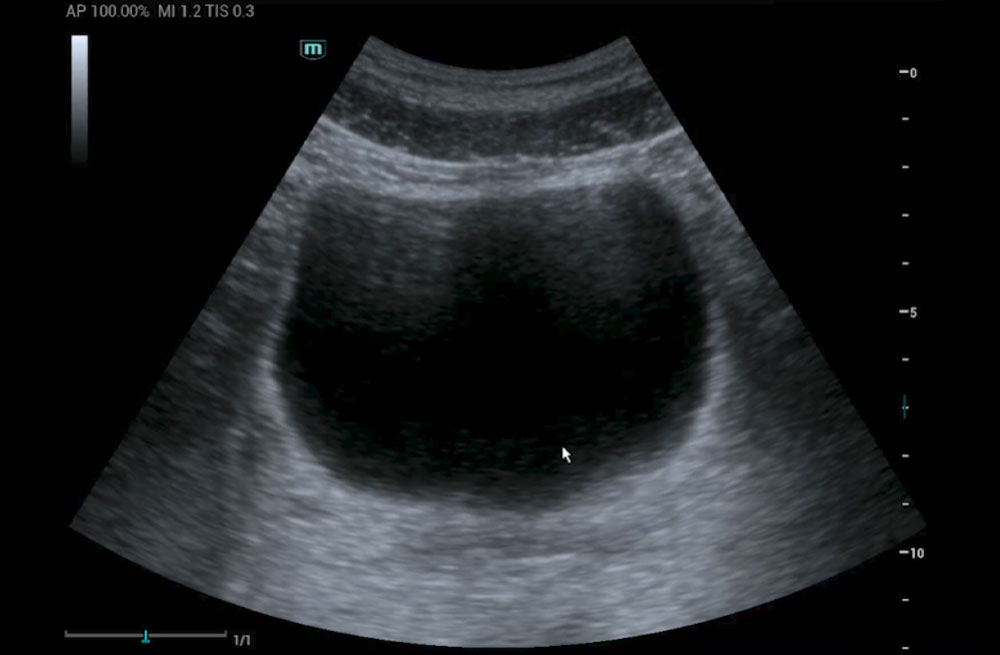 Mindray MU7 – Diagnostic Ultrasound System - Image 11