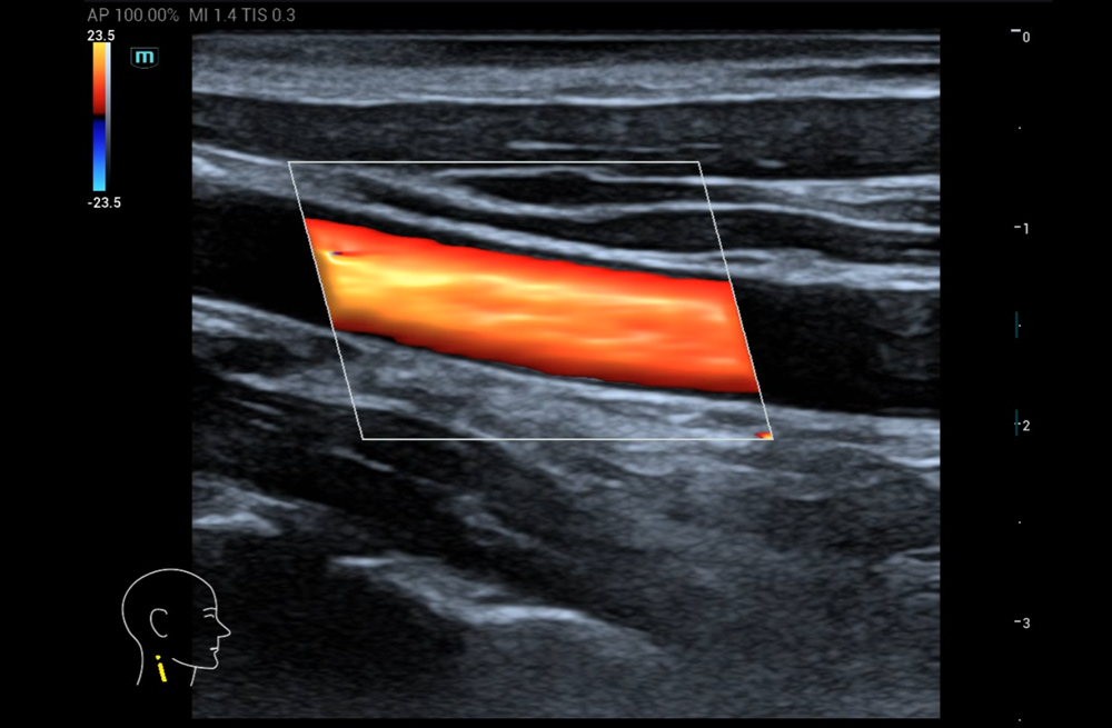 Mindray MU9 – Diagnostic Ultrasound System - Image 15