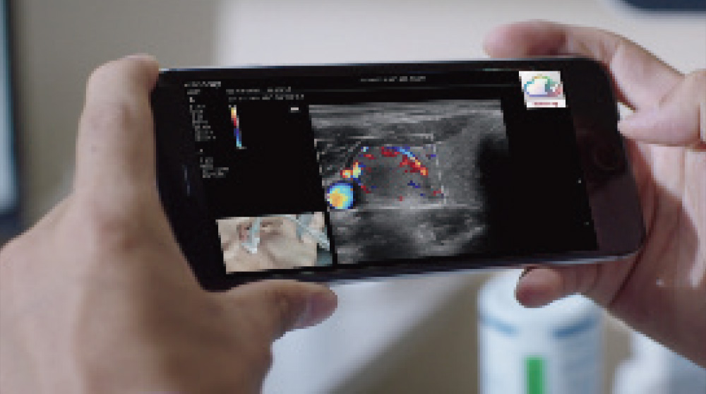 Mindray MU7 – Diagnostic Ultrasound System - Image 16