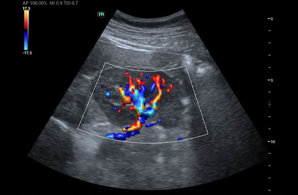 Mindray MU7 – Diagnostic Ultrasound System - Image 8