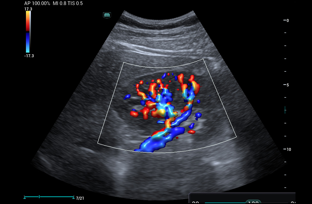 Mindray MU9 – Diagnostic Ultrasound System - Image 11