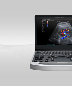 Mindray MU7 – Diagnostic Ultrasound System